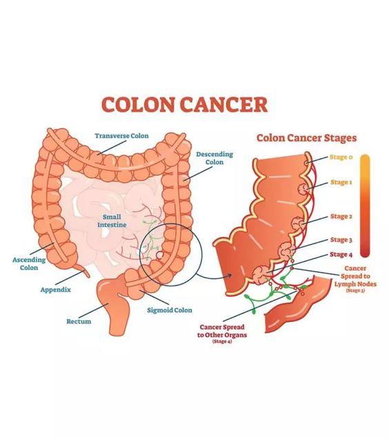 Truth about colon broom reviews health products