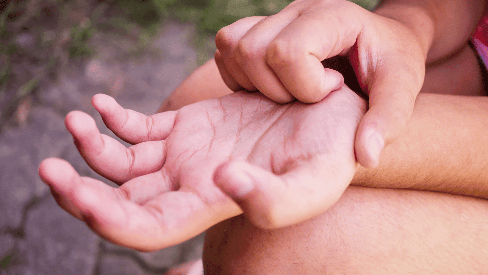 Do Itchy Palms Indicate Monetary Gains?